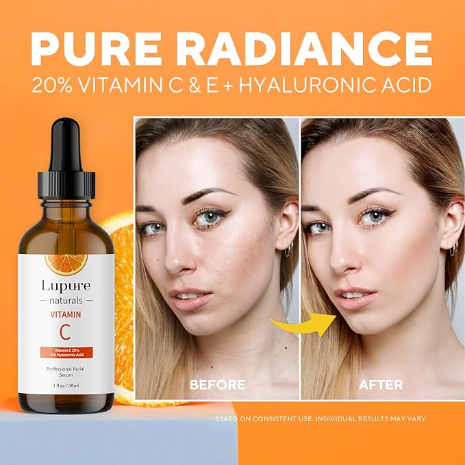 Professional Vitamin C Face Serum 20%, Anti Aging Facial Super Vit C Serum with Ascorbic Acid Hyaluronic Acid & Vitamin E for Dark Spots, Skin Care, Christmas Gift & Stocking | 1 Fl. Oz-GlimoraGlow