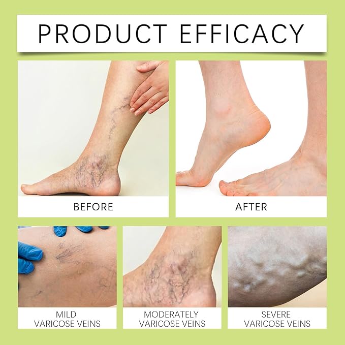 Miracle Balm, Soothing Balm for Joints, Back, Legs & Feet, Non-Greasy (3PCS)-GlimoraGlow