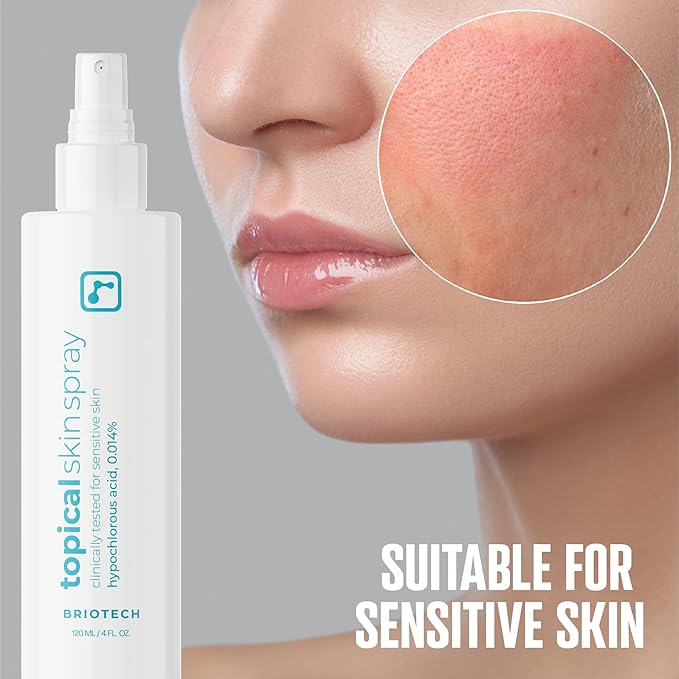 BRIOTECH Topical Skin Spray, Hypochlorous Acid Spray for Sensitive Skin, HOCl Facial Mist, Full Body Support Against Irritation, Calm Redness, Soothe Foot & Scalp, 2 oz Travel Size-GlimoraGlow