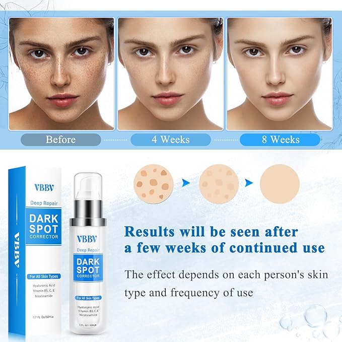 Dark Spot Remover for Face and Body, Dark Spot Corrector, Age Spot Sun Spot Freckles Dark Spot Remover, Melasma Treatment for Face, Advanced Skin Care Cream for Women and Men (1.7 Fl Oz)-GlimoraGlow
