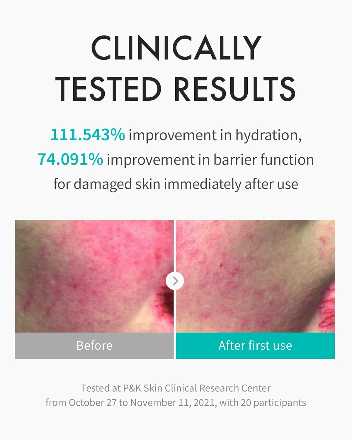 REJURAN® Moisture Treatment Ampoule, c-PDRN® - Deep Hydrating Face Serum for Instant & Long-Lasting Moisture, Soothing, Skin Barrier Boost, Moisture Lock with PDRx. Korean Skin Care (1.01 fl oz)-GlimoraGlow