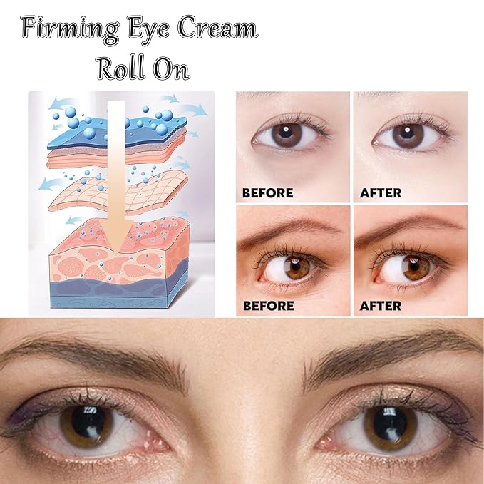 Caffeine Eye Cream Eye Serum, Under Eye Roller Cream for Dark Circles and Puffiness, 0.51 Fl Oz-GlimoraGlow