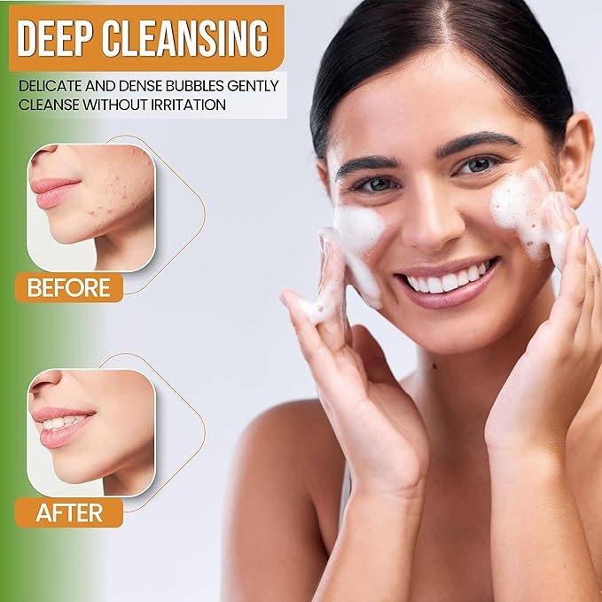 Turmeric Face Wash - Turmeric Facial-Cleanser with Aloe Vera, Vitamin E, and Natural Extracts - Lightweight Daily Gel Face Wash for All Skin Types - 120ml-GlimoraGlow