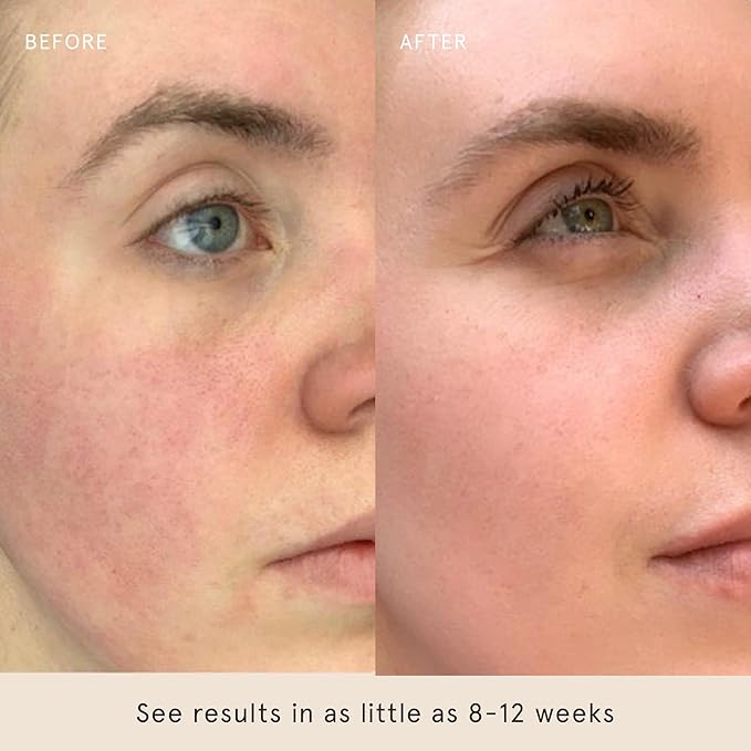 Barefaced Sheer Protection SPF 50+ – Broad-Spectrum Face Sunscreen for women with Zinc Oxide, Niacinamide & Hyaluronic Acid – Oil-Free UV Protection, Hydration & Anti-Aging with Universal Tint (60ml)-GlimoraGlow