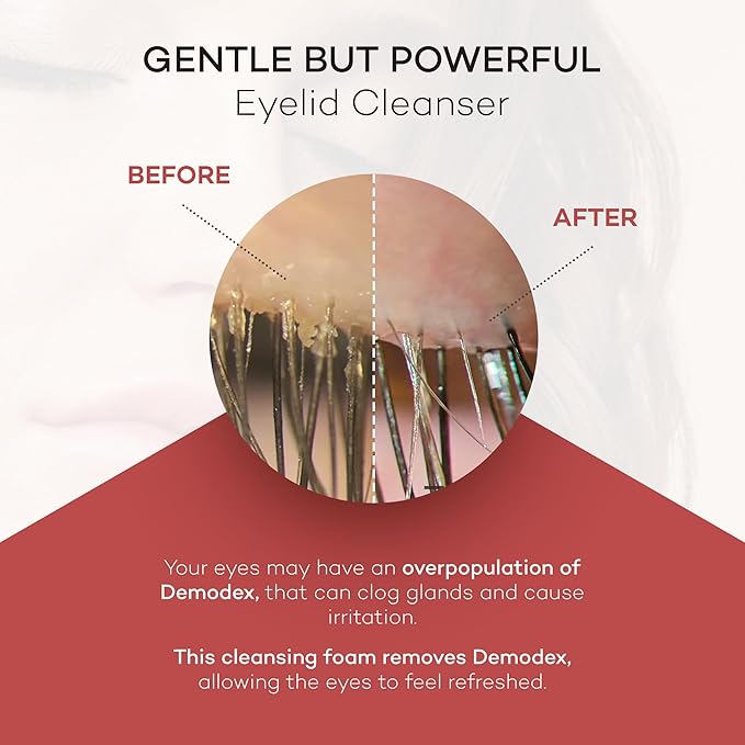 ZocuFoam Eyelid Cleanser - Foaming Eyelid Scrub - Natural pH Balanced Solution - 25mL-GlimoraGlow