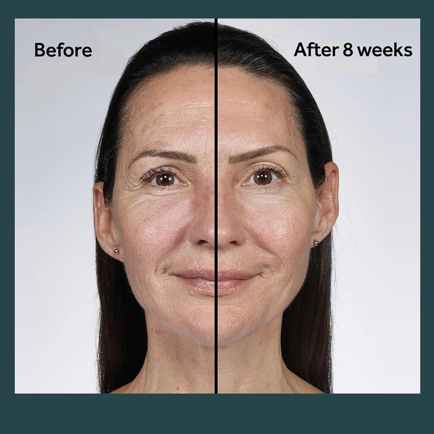 No7 Future Renew Damage Reversal Night Cream - Anti Aging Face Moisturizer - Infused with Peptide Technology to Reverse Visible Signs of Damage - Skin Barrier Repair for Dry Skin (1.69 Oz)-GlimoraGlow