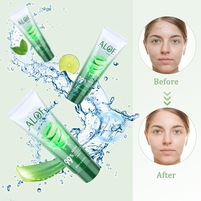 200x2 ML Aloe Vera Gel – 99% Organic Pure Aloe Vera Hydrating Face & Body Moisturizer, Natural Aloe Cream for Dry Skin, Sunburn, Acne, Soothing & Moisturizing-GlimoraGlow