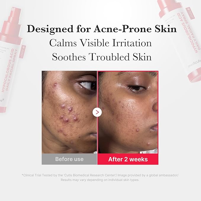 medicube Power Soothing Spray | Hypochlorous Acid Spray For All Skin Types, Delicate Skin | Daily Skin Solution & Post-Sun Care | HOCI Facial Mist for Soothing & Calming | Korean Skincare | 4.22 fl.oz-GlimoraGlow