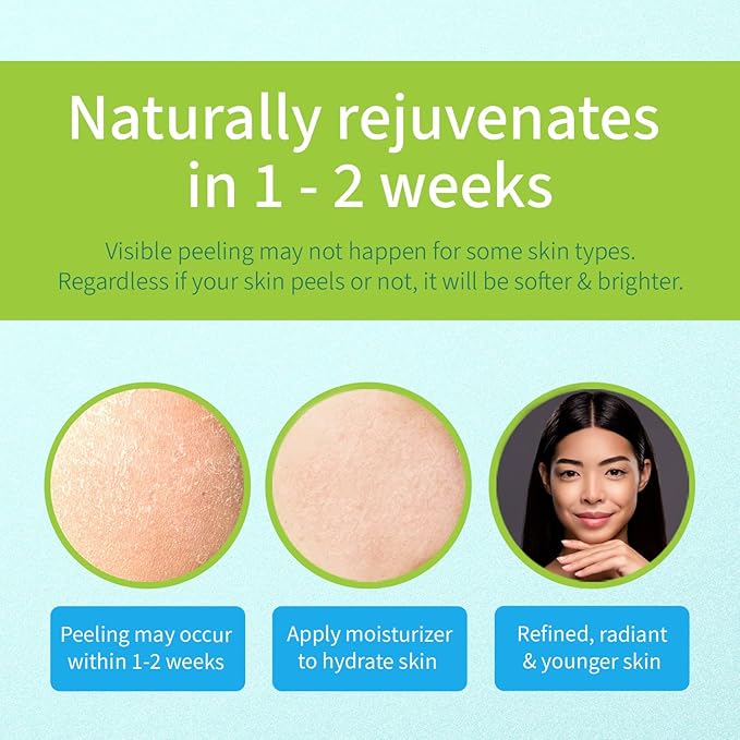 Ebanel Chemical Peel for Face, AHA BHA Exfoliator, Glycolic Acid Peel, Salicylic & Lactic Acid Face Peeling Gel, Infused with Green Tea & Chamomile for Acne Scars, Dark Spots, Wrinkles, Fine Lines-GlimoraGlow