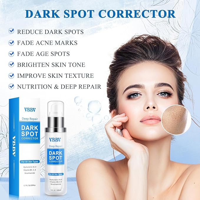 Dark Spot Remover for Face and Body, Dark Spot Corrector, Age Spot Sun Spot Freckles Dark Spot Remover, Melasma Treatment for Face, Advanced Skin Care Cream for Women and Men (1.7 Fl Oz)-GlimoraGlow