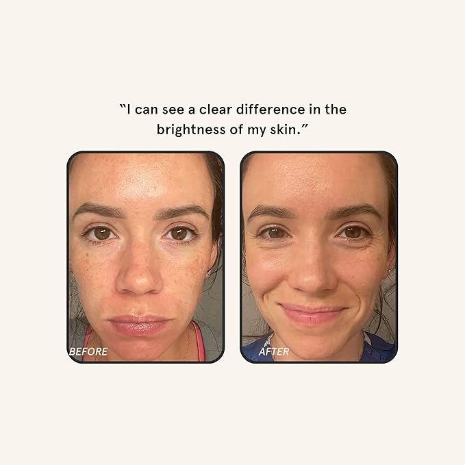 Barefaced Liquid Gold 1 Fl Oz - 15% Vitamin C Serum with Hyaluronic Acid & Vitamin E for Anti-Aging, and Hydration, Antioxidant Formula, Reduces Dark Spots, Acne & Wrinkles-GlimoraGlow