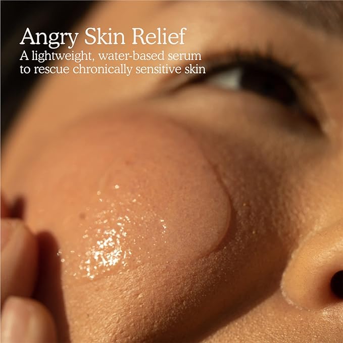 Tower 28 SOS Intensive Rescue Serum for Sensitive Skin, Hypochlorous Acid Skin Care, Helps Reduce Face Redness, Safe for All Skin Types, 2 FL Oz-GlimoraGlow