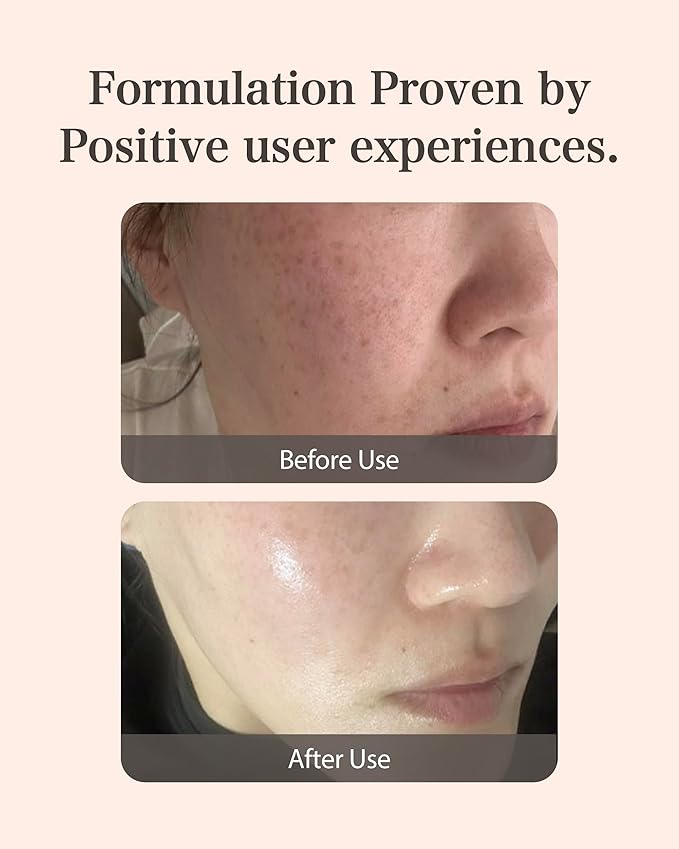 MASTINA Mastic Ampoule Serum Dropper Type (0.5fl oz, Pack of 2) White Mastic Complex 63%, Tranexamic Acid 2%, Niacinamide 5% - Face Serum for Firming, Hydrating, Radiant Glass Skin. Korean Skin Care-GlimoraGlow