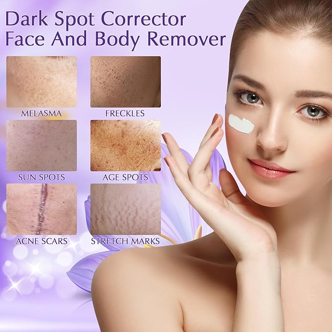 Dark Spot Remover for Face Cream, Dark Spot Corrector, Rapid Tone Repair Retinol Serum for Sun Spots, Age Spots, Skin Brown, Melasma Skin Care with Upgraded Formula Vitamin C for Women 1.7 Fl OZ-GlimoraGlow