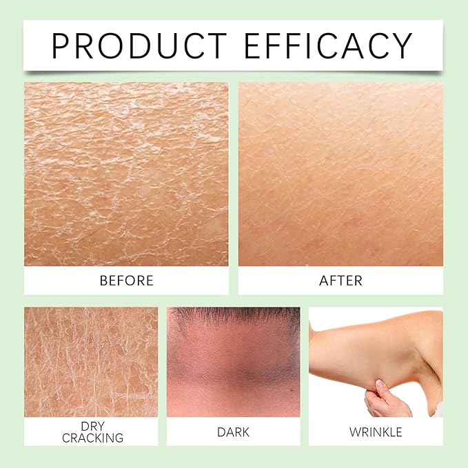 Body Lotion from Korea Whitening Remove Dark Spots, Original Niacinamide Whitening Body Lotion for Dry, Rough & Sensitive Skin, Moisturizing & Nourishing (1)-GlimoraGlow