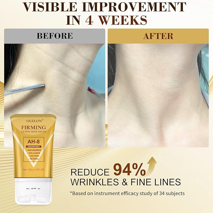 [2025 Upgrade] AH8 Firming Neck Cream with Roller - Tightening & Lifting Cream for Sagging Skin, 8-HA Clockwise Neck Cream for Face & Body Skin Tightening Cream with Massage Roller-GlimoraGlow