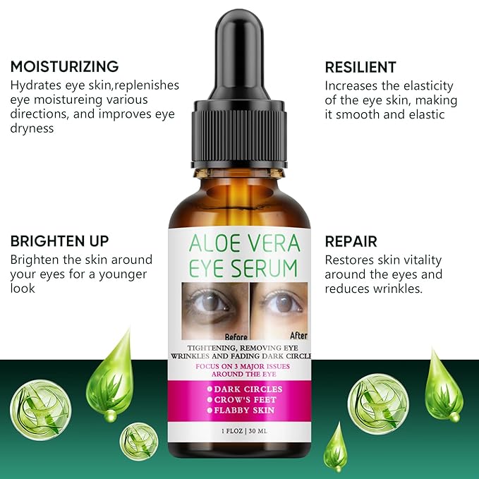 Aloe Vera Eye Serum Dark Circles Under Eye Treatment for Women to Reduce Appearance of Puffy Eyes Eye Bags Fine Lines and Wrinkles for All Skin Types, Beauty Skin Care Gift-GlimoraGlow