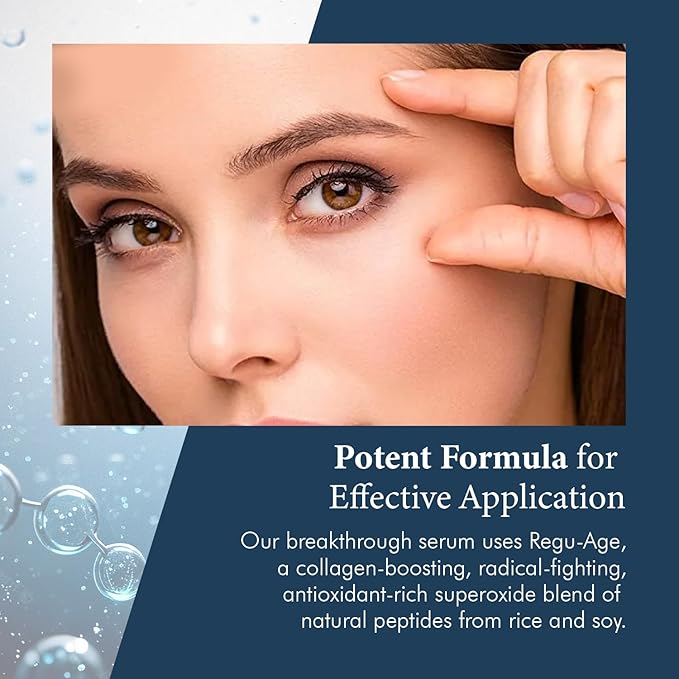 Extreme Dark Circle Serum - Under Eye Treatment for Dark Circles, Puffiness, Wrinkles & Fine Lines - Revitalizing, Anti-Aging & Eye Depuffer Serum for Eye Skin Care l 30 ml-GlimoraGlow