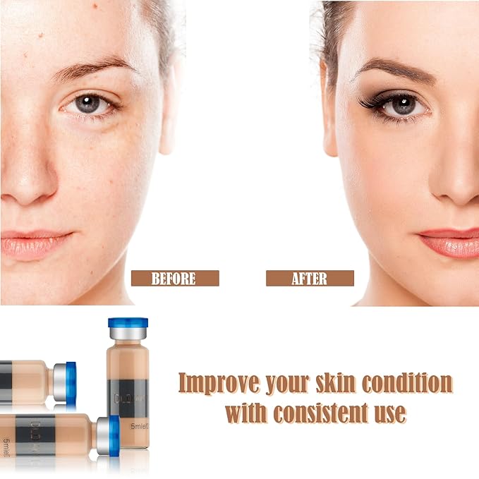 BB Facial Glow Starter Kit Facial Pigment Serum Treatment Kit,Anti-Aging Serum Pigments Set for Micro-needling Skin Treatment 10 Vials 5ml Hyaluronic Acid Ampoule foundation Essence Skin-GlimoraGlow