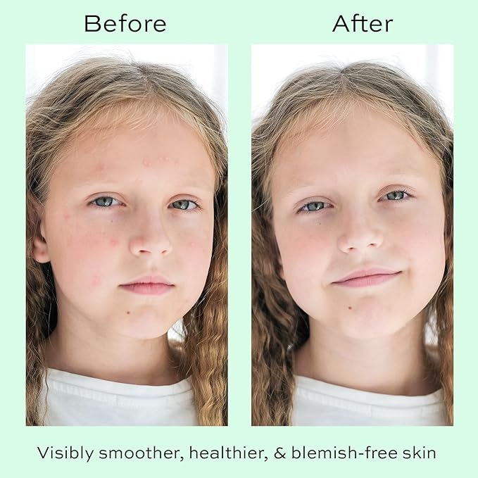 Face Moisturizer with Hyaluronic Acid Face Cream for Kids - Facial Cream & Gentle Moisturizer with Strawberry Extract & Vitamin E - Daily Facial Cream Moisturizer for Dry & Sensitive Skin 50ml-GlimoraGlow