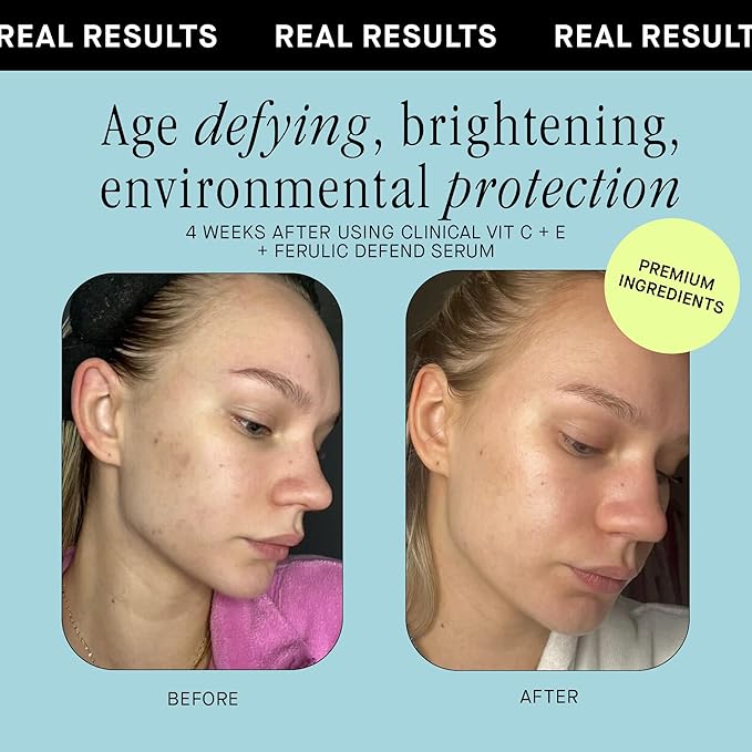 Brandefy Vitamin C Face Serum 15% L. Ascorbic Acid, Ferulic Acid .5% + Vitamin E for Self Care and Beauty, Face Dark Spot Corrector and Anti Aging 1oz, Made In The USA-GlimoraGlow