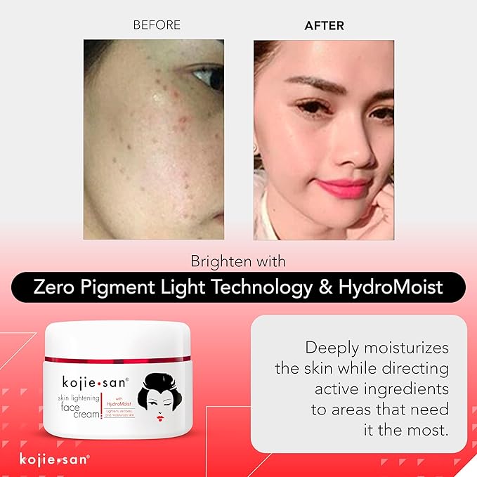 Kojie San Face & Body Complete Brightening Mini Set - 65 Gram x 2 Bars Soap, Body Lotion, Face Cream, and Facial Cleansing Brush-GlimoraGlow