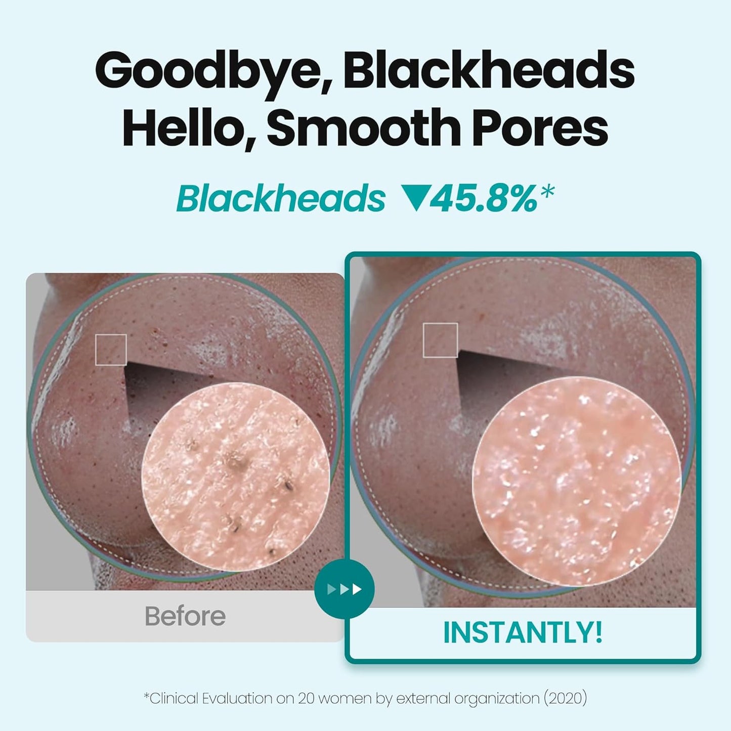 [K-Beauty] Blue Tansy Oil to Foam - All-in-One Korean Face Wash OilBased Foaming Facial Cleanser - Excess Sebum & Oil Control - Makeup Deep Cleansing Oil for All Skin Types (3.88 fl oz)-GlimoraGlow