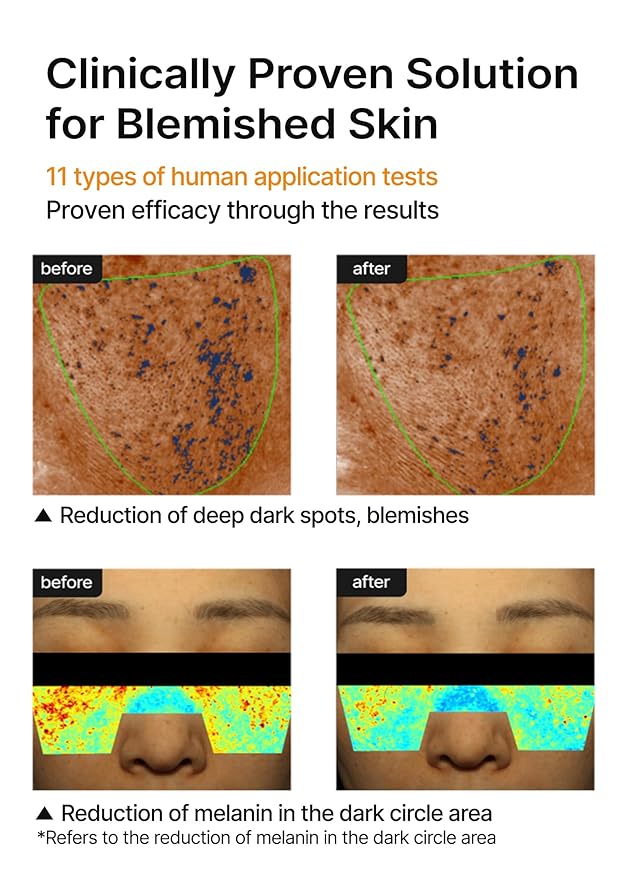 celimax Pore+Dark Spot Brightening Cream | with Niacinamide, Tranexamic Acid, TXA Cream, Pore Minimizer, Non-Irritating, Hydrating, For Sensitive Skin, 35ml-GlimoraGlow