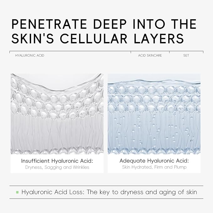 Hyaluronic Acid Skin Care Set, Hydration Kit for Women Teen Girls, Low pH Cleanser, Moisturizer, Serum, Eye Cream, Anti Aging, Firming, Travel Size Facial Care Gift Set for Dry Sensitive Skin-GlimoraGlow