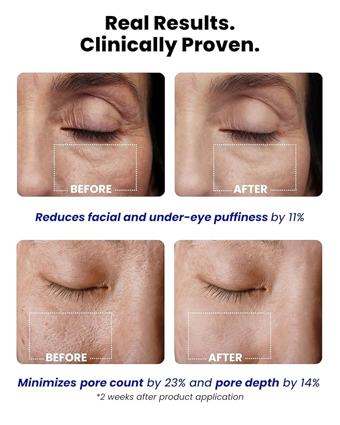 Ice Roll Serum | Cooling & Hydrating Roll-On Serum for Face, Puffy Eyes, Tannin & Panthenol for Pore Minimizing, Soothing, Facial Roller for Depuffing, Under Eye Bag Treatment | Korean Skin Care-GlimoraGlow