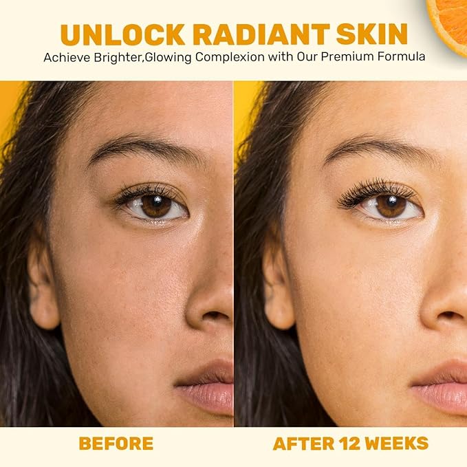 Gentle Vitamin C Serum – Brightening & Hydrating with Citrus Stem Cells and Chamomile, Safe for Rosacea & Sensitive Skin, 1oz-GlimoraGlow