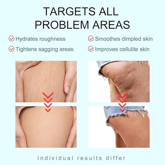 B-TIGHT Body Cream, 200ml Leave-On Booty Enhancing Mask, Firming & Moisturizing Cream, Leave-On Cellulite Mask - Improves Skin Tightness in Buttock Area, Lift sagging skin - 6.76 oz-GlimoraGlow