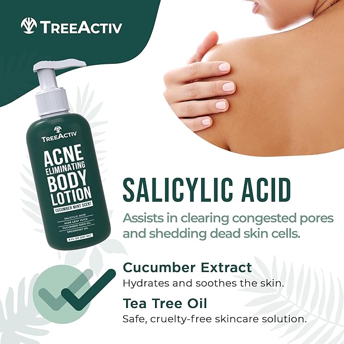 TreeActiv Acne Eliminating Body Lotion 8 fl oz | Clears Body, Back, Butt and Shoulder Acne | Anti-Acne Moisturizer | Prevents Future Breakouts | Cucumber Mint Scent-GlimoraGlow