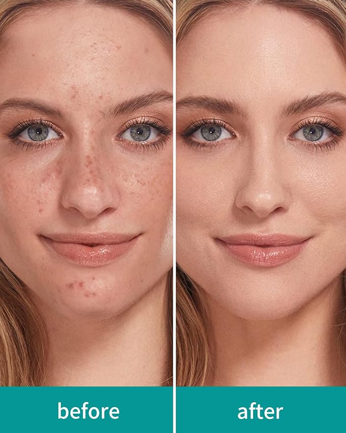 EIGSHOW Foundation and Concealer Brush, Dual Ended Makeup Brush For Flawless Foundation Coverage, Under Eye Concealer, Vegan & Cruelty-free (D110B)-GlimoraGlow