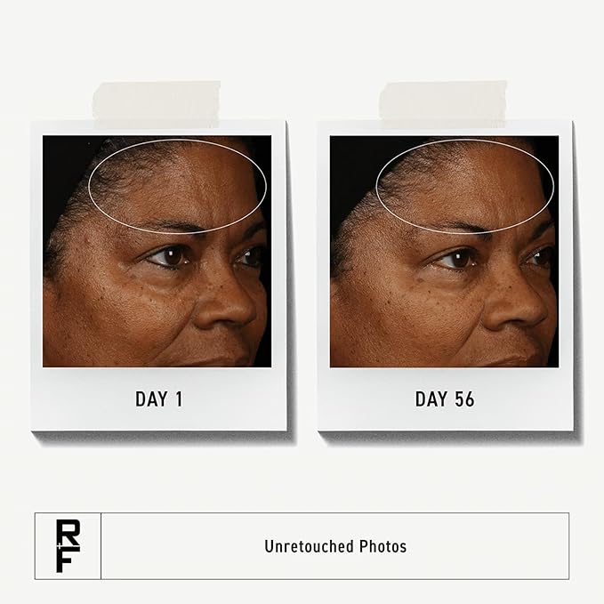 Rodan + Fields Redefine Regimen | Skincare Kit Includes Clay Cleanser, Toner, Triple Defense Cream, & Overnight Cream | Skin Care Gift Set for Women-GlimoraGlow