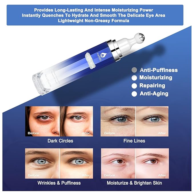 Under Eye Cream with 8% Caffeine & Retinol | Hyaluronic Acid, Niacinamide & Peptides | Eye Roller for Puffy Eyes, Dark Circles & Wrinkles | 2 fl. oz.…-GlimoraGlow