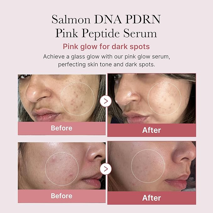medicube Salmon DNA PDRN Pink Peptide Serum, Pink glow serum, Peptide, Niacinamide, Hydrating & Moisturizing & Firming, Uneven Skin Tone, Korean Skincare | 1.01 fl.oz. (1.01 fl.oz., Salmon DNA PDRN)-GlimoraGlow
