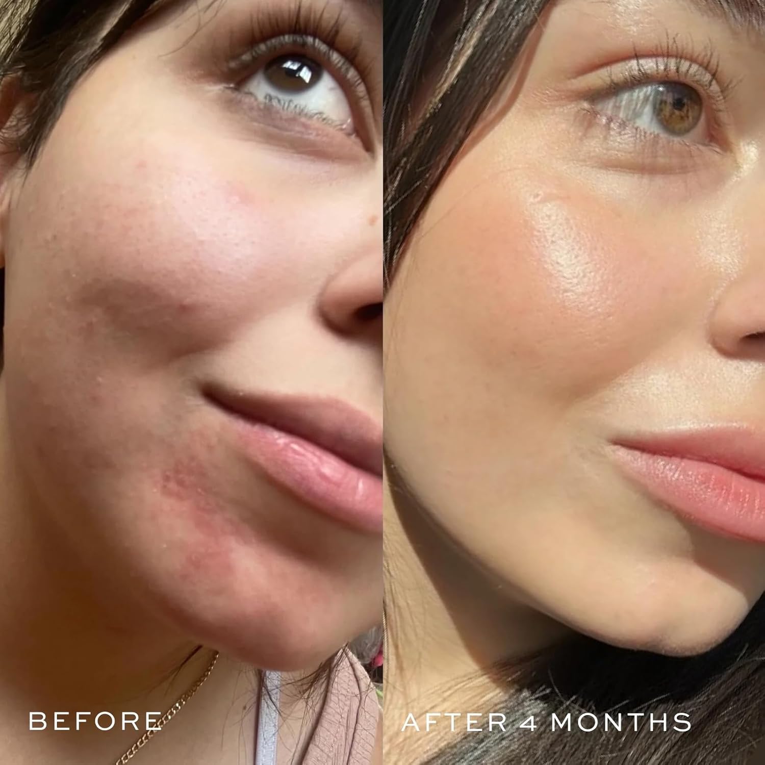 DIME Beauty Blue Facial Oil, 1 oz / 30 mL - Blemish Spot Treatment with Blue Tansy, Black Cumin Seed, Rosehip, and Grapeseed Oils-GlimoraGlow