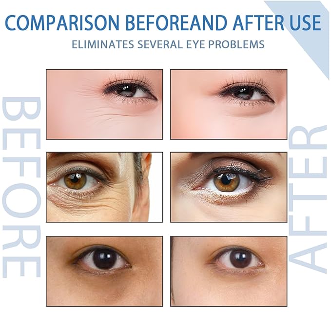 Peptide Depuffing Eye Serum, Himeye Peptide Eye Serum, Men's Caffeine Eye Serum, Men's Collagen Anti-Aging Eye Cream for Wrinkles, 0.5 Ounce (Pack of 2)-GlimoraGlow