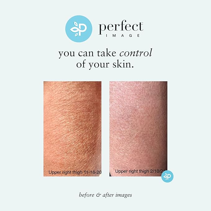 Perfect Image Gly + Sal Exfoliating Body Lotion, 8% Glycolic Acid and 2% Salicylic Acid Lotion Enhanced with Green Tea, Papaya, Bearberry, Licorice and Amino Complex-GlimoraGlow