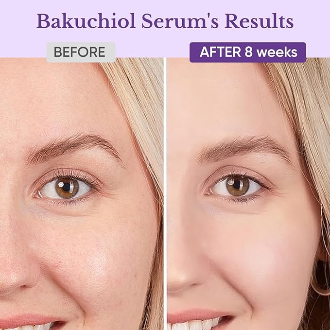 Bakuchiol Retinol Serum for Face, Retinol Alternative for Sensitive Skin with Vitamin E, Hyaluronic Acid, Collagen, Serum for Anti-Aging, Wrinkle Reduction Skin Firming & Smoothing 1 oz-GlimoraGlow