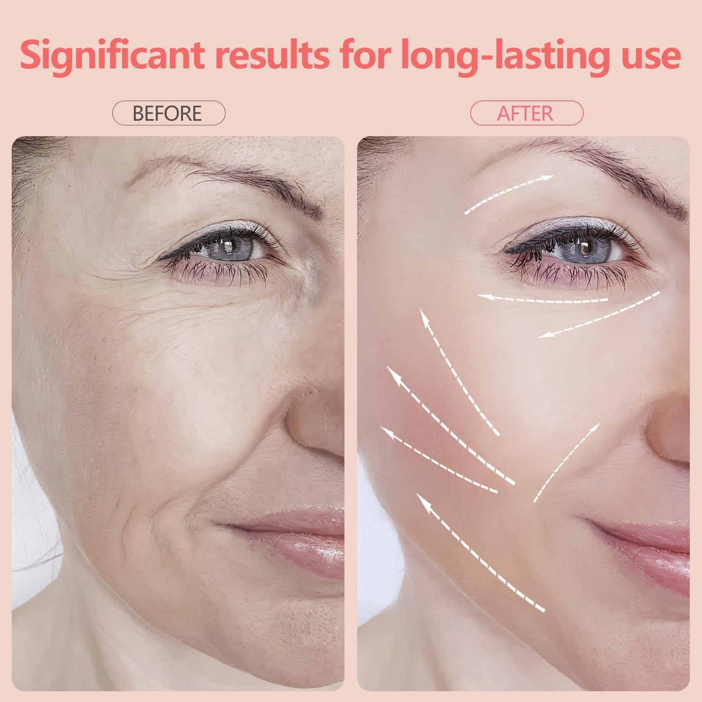 2025 New Face and Neck Massager Tool, 7 Colors LED Womens Skin Care Facial Massager for Skin Rejuvenation, Lifting, Toning, Glow Boost-White-GlimoraGlow