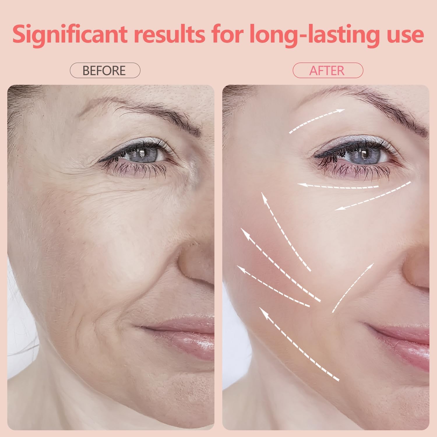 2025 New Face and Neck Massager Tool, 7 Colors LED Womens Skin Care Facial Massager for Skin Rejuvenation, Lifting, Toning, Glow Boost-White-GlimoraGlow