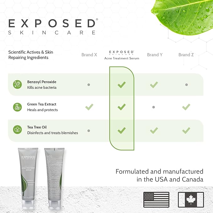 Exposed Skin Care Acne Treatment Serum Step 3 – Quickly Reduces Pimple Size and Redness - 12 Hour Spot Treatment - 3.5% Benzoyl Peroxide, Natural Green Tea & Tea Tree Oil-GlimoraGlow