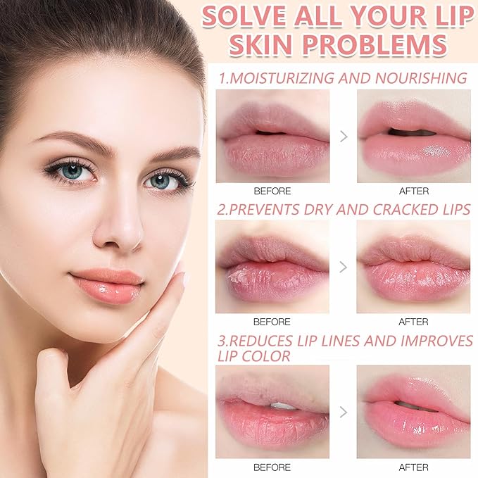 1PCS Lip Balm Honey Pot,Honey/Apple Lime Lip Mask Overnight Moisturizing Lip Balm,Hydrating Prevention Dry & Cracked Lip Exfoliator Lip Wrinkle Care Sleeping Lip Mask (Apple Lime)-GlimoraGlow