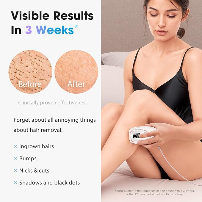 IPL Laser Hair Removal Device for Women & Men - Home 45°F Ice-Cooling Contact for Painless & Long-Lasting Results, 86% Hair Reduction in 3 Weeks for Full Body & Bikini Line, White-GlimoraGlow