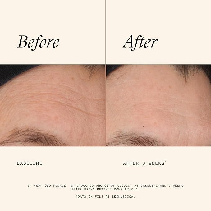 SkinMedica Retinol 0.5 Complex - Retinol Serum for Face, Age-Defying Advanced Retinol Cream That Renews Skin and Diminishes the Appearance of Fine Lines and Wrinkles, 1 Fl Oz-GlimoraGlow