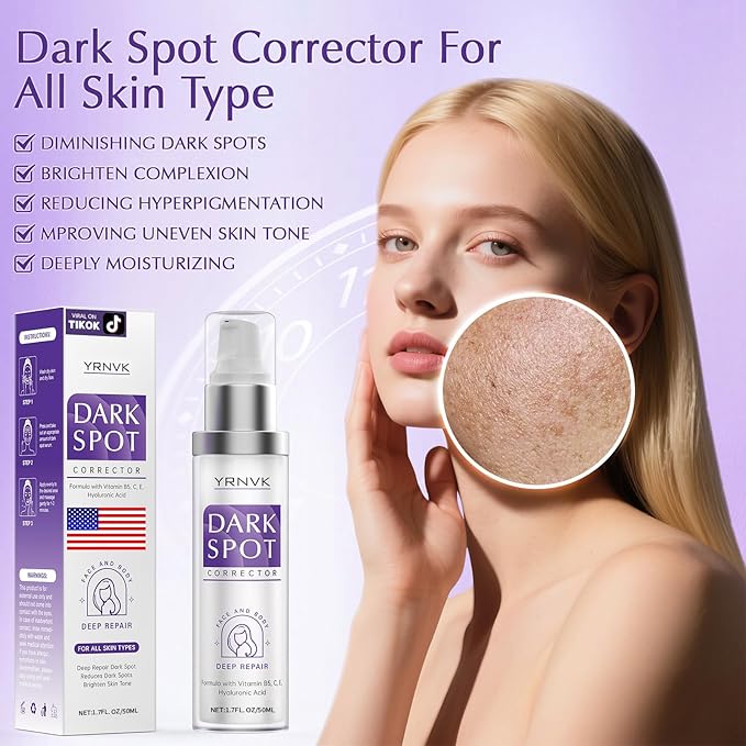 Dark Spot Remover for Face Cream, Dark Spot Corrector, Rapid Tone Repair Retinol Serum for Sun Spots, Age Spots, Skin Brown, Melasma Skin Care with Upgraded Formula Vitamin C for Women 1.7 Fl OZ-GlimoraGlow