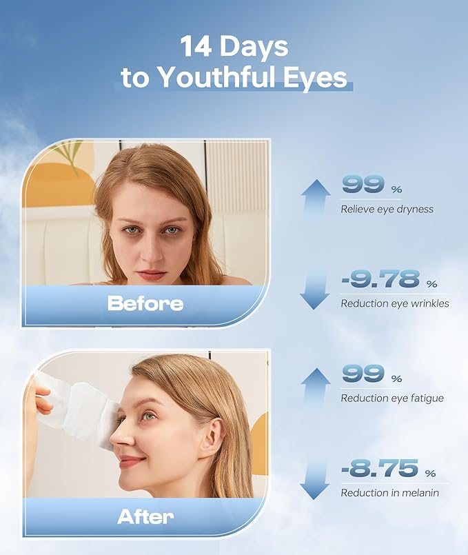 Hyaluronic Acid Self Heating Warm Compress for Eyes, Heated Eye Mask for Fast Relief of Dry Eyes, 14 Pack Steam Eye Mask, Moisturizing & Highly Effective Steam Eye Mask-GlimoraGlow