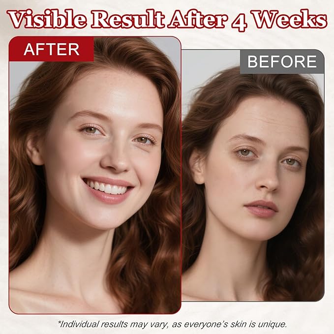 SINPIN aobenz Anti Aging Moisturizer Face Cream for Women & Men - Night Cream for Face & Neck | All Skin Types | Niacinamide + Hyaluronic Acid | Firming, Tightening, Anti Wrinkle, 1.76FL (1PCS)-GlimoraGlow